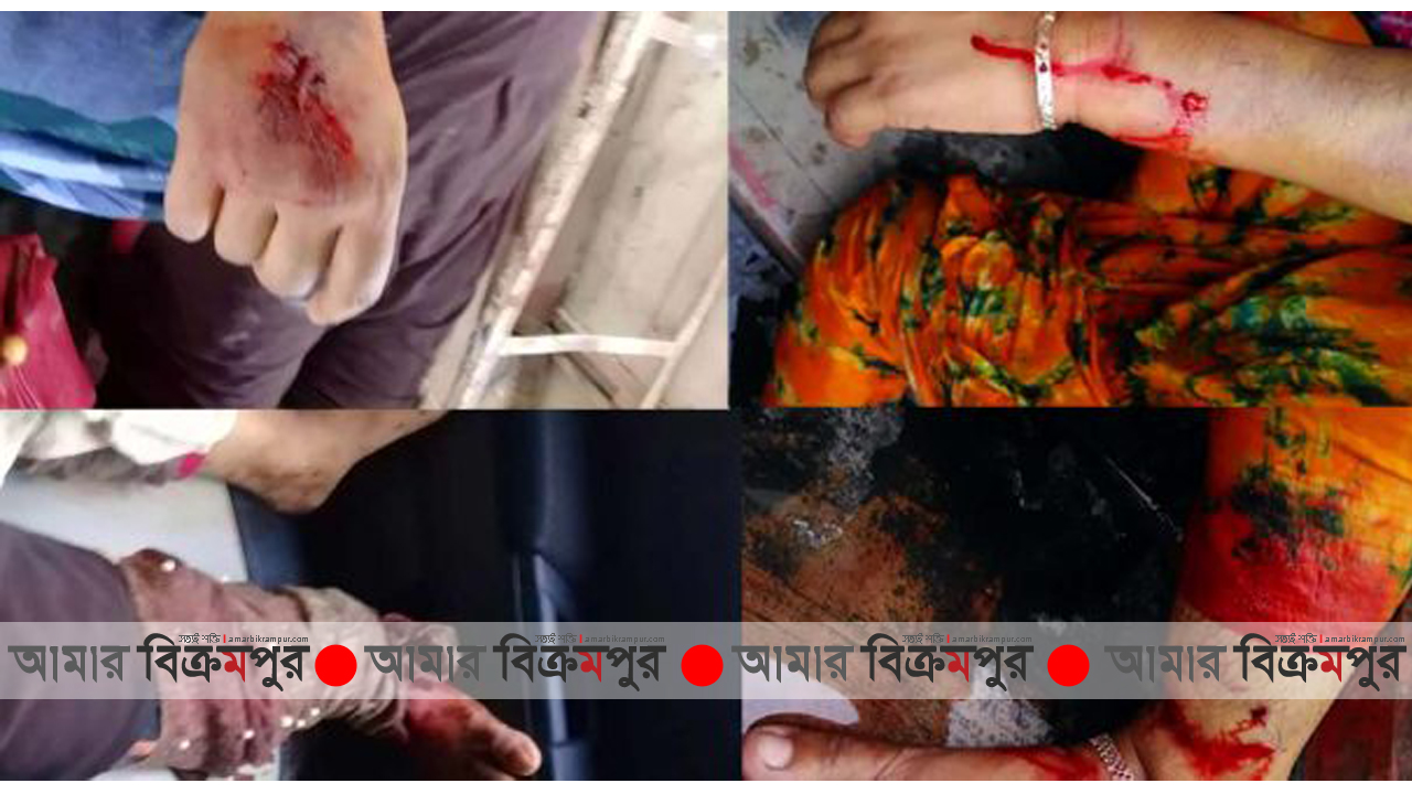 মুন্সিগঞ্জে গৃহবধূকে কুপিয়ে জখম